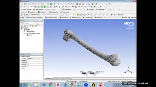 Session-12: Biomechanical Analysis of Femur Bone using ANSYS Workbench