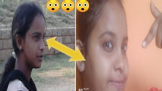 say  goodbye to pimple and dry skin /ನಿಮ್ಮ ಮುಖ ಕಪ್ಪಾಗಿ  ಇದೀಯಾ ಇಲ್ಲವೇ  ಪರಿಹಾರ /kannada  beauty tips