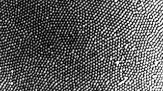 Mosquito Eye (2005) Scanning Electron Microscope Zoom