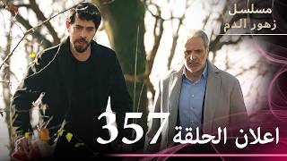 اعلان الحلقة 357 | مسلسل زهور الدم | مدبلج بالعربية | Kan Çiçekleri