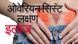 Ovarian cyst ke lakshan | Ovarian cyst kaise thik kare | ओवरी में गाँठ | Ovarian cyst kya hota hai?