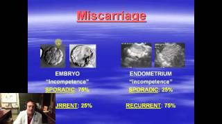 Webinar - Geoffrey Sher, MD - Recurrent Miscarriage