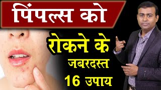 पिंपल्स को रोकने के जबरदस्त 16 उपाय।How To Remove Pimples | Acne Treatment hindi