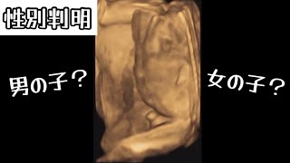 【性別判明】3人目は男の子？女の子？この画像でわかりますw