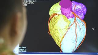 Philips cherishes every heart - Cardiology AFCC 2016