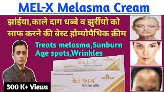 MEL-X melasma cream full review in hindi / झाईयों को साफ करने की बेस्ट होम्योपैथिक क्रीम