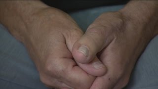 Toe-thumb transplant