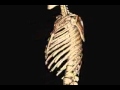 Skeleton from Helical CT Scan
