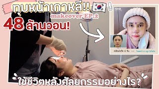 ทุบหน้า Ep.2 : VLOG ใช้ชีวิตหลังศัลยกรรมทั้งหน้า เจ็บรึป่าว?! | YuRi Ukuri