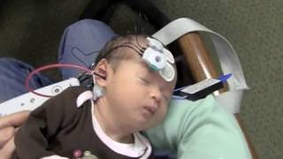 Newborn Hearing Testing Screening (OAE and ABR)