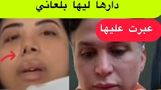 🛑🛑صوفيا طالوني يكشف الحقيقة  بلعاني شوهت ليها نيفها  و انتاقمت  من نوال الحكومة