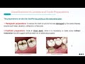 nomenclature and classification of cavities and tooth preparations part 2