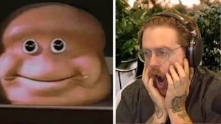 Wubby Reacts To Plastic Surgery Gone Wrong