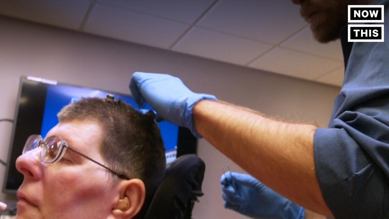 Paralyzed Man Moves Via Brain Implant | NowThis - YouTube