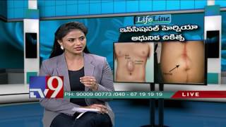 Incisional Hernia - Latest Treatment - Lifeline - TV9