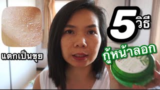 5 วิธี แก้ปัญหา หน้าลอกเป็นขุย ใช้จริง เห็นผลจริง