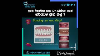 දන්ත විකෘතිතා ගැන Dr. Shine ගෙන් හරියටම දැන ගමු ?