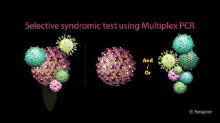 Seegene's complete solution for COVID-19 response