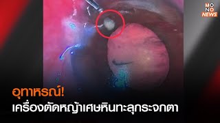 อุทาหรณ์! เครื่องตัดหญ้าเศษหินทะลุกระจกตา  | เรื่องเด่นประเด็นดัง TopTalk | 31 ต.ค. 65