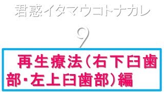 #顕微鏡歯科 #マイクロ #歯周病 #歯周外科 #マイクロスコープ　右下・左上の再生療法の手術　従来の手術用顕微鏡の応用方法では治療が難しい理由