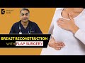 DIEP Flap for BREAST RECONSTRUCTION(with Abdominal Flap)|BREAST CANCER-Dr.Srikanth V|Doctors' Circle