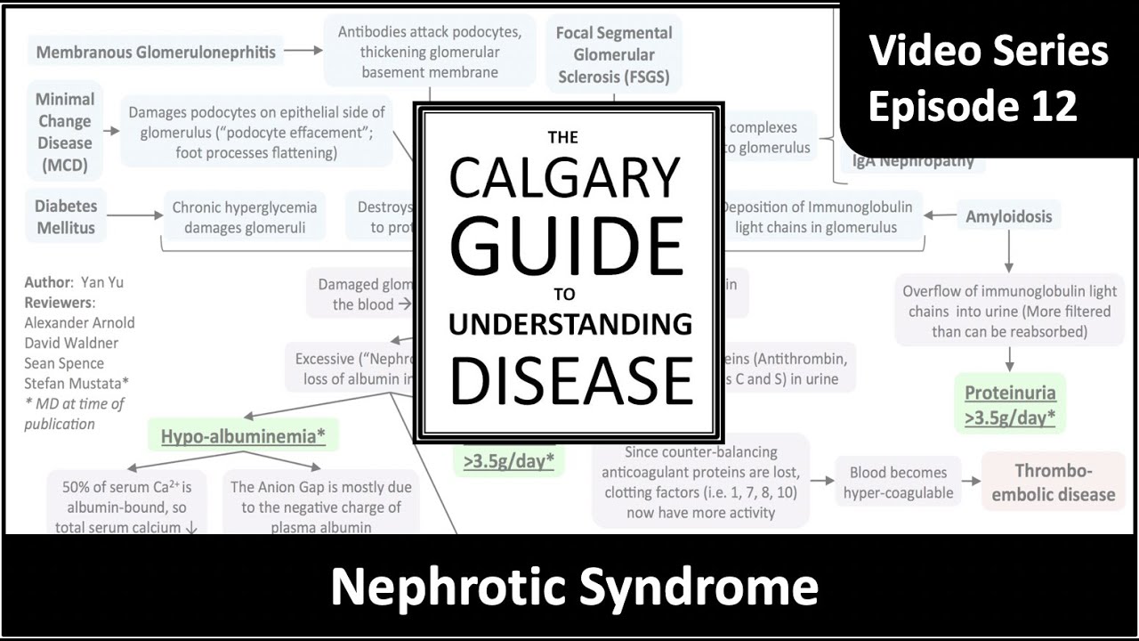 Nephrotic Syndrome: Pathogenesis And Clinical Findings - YouTube