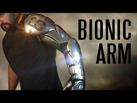 Watch this Guy build a Bionic Arm Watch this Guy build a Bionic Arm