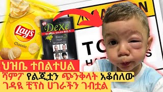 ሻምፓ የልጂቷን ጭንቅላት አቆሰለው #ችፕስ #ድንች_ጥብስ #ሻምፓ