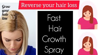 Regrowth Hair Spray ,Extreme Hair Growth Spray, Reverse Your Hair Loss. #haircare #hairlosssolution