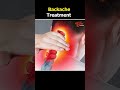 backpain... teluguonehealth teluguhealthtips healthtipstelugu latesthealthtips backpain viral