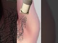 Remove Hairs From Girl's armpit #asmr #animation