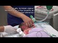 paediatric anaesthetics chapter 1 inhalational induction neonate