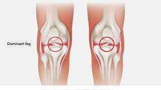 Mechanical loading induces ACL hypertrophy