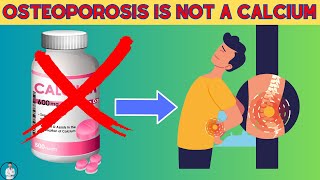 The Truth About Calcium And Osteoporosis That You Must Know | Christiansen Felix