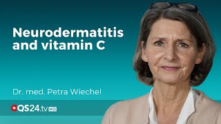 My child has neurodermatitis | Dr. med Petra Wiechel | Visite | 🇨🇭QS24 Swiss Health Television