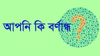 আপনি বর্ণান্ধ (color blind) কিনা পরীক্ষা করে দেখুন