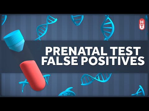 How accurate is NIPT for trisomy X?