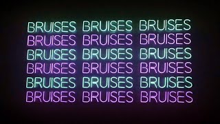 IZKO, MOLOW - Bruises (Lyrics) ft. Jay Mason