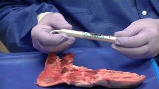 NV® PRO3 Microlaser Procedures - Aphthous Ulcer -  DenMat Dental Education