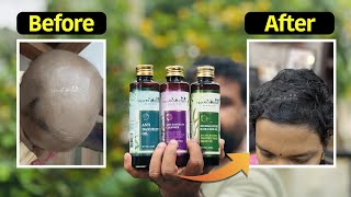 മുടിയുടെ എല്ലാവിധ പ്രശ്ങ്ങൾക്കും പരിഹാരം! | Solutions for Every Hair Problem!