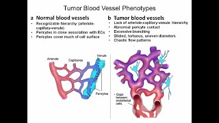 Targeting Cancer Pathways: Tumor Metabolism and Proliferation