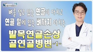 뼈를 덮고 있는 연골이 다치고 연골 밑에 있는 뼈까지 다치는 '발목연골손상 골연골병변' 1편