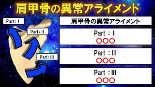 【リハビリ】患者さんの肩甲骨はこの３つのパターンになっています！！【理学療法士スキルアップセミナー】