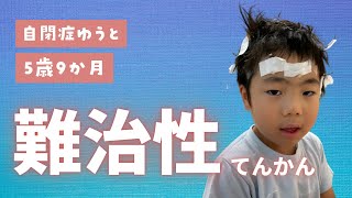 難治性てんかんジーボンス症候群って何？治療法は？【知的障害・自閉症】