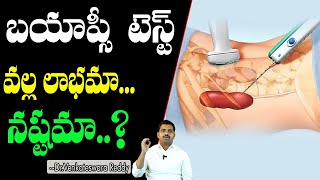 బయాప్సి వల్ల లాభమా.. నష్టమా..? | What is Biopsy Test for Cancer In Telugu | Dr.Venkateshwara Reddy