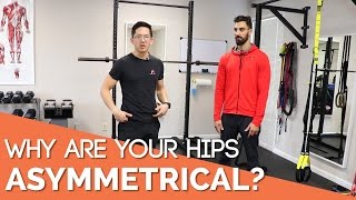 Uneven hips? Why you have asymmetrical hips!