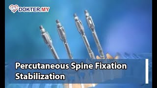 Percutaneous spine fixation stabilization