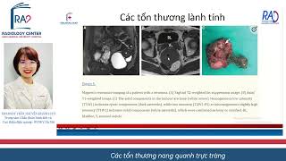 CÁC TỔN THƯƠNG NANG QUANH TRỰC TRÀNG