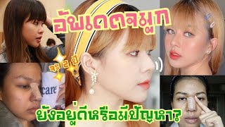 Q&A: จมูกสวยพาชีวิตเปลี่ยน! จมูกบิดได้ไหม? จมูกยังอยู่ดีไหม? อัพเดตหลังทำจมูกจะครบ 2 ปี | MAYNESSA