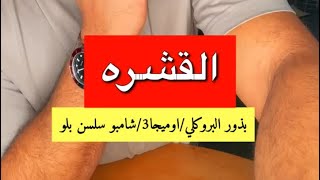 بوضاري تخلص من القشره